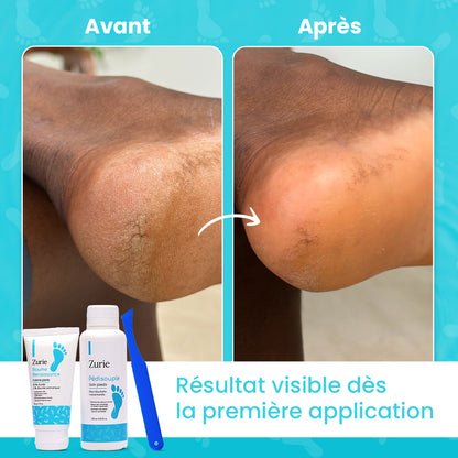 Pack des pieds zurie