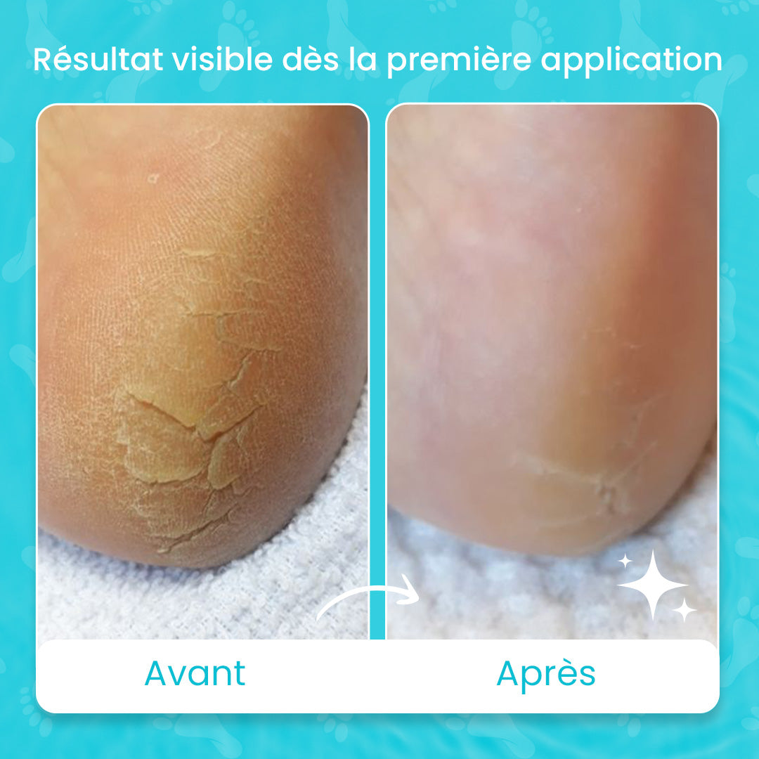 Pack des pieds zurie