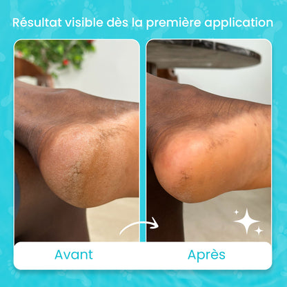 Pack des pieds zurie